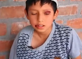 H0901002 Sufrimiento de un niño en manos de su hermana